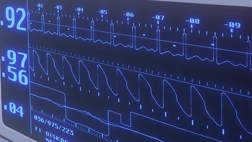 Lost Hope (Remastered)